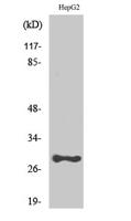 PSCA Polyclonal Antibody