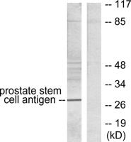 PSCA Polyclonal Antibody