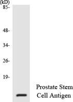 PSCA Polyclonal Antibody