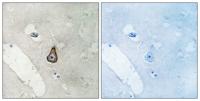 PSD-93 Polyclonal Antibody