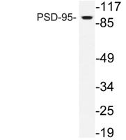 PSD-95 Polyclonal Antibody