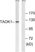 PSK2 Polyclonal Antibody