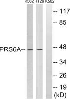 PSMC3 Polyclonal Antibody