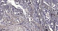 PSMC6 Polyclonal Antibody