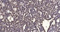 PSP Polyclonal Antibody