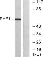 PHF1 Polyclonal Antibody