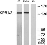 PHKA1/2 Polyclonal Antibody