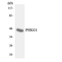 PHKG1 Polyclonal Antibody