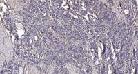 Phocein Polyclonal Antibody