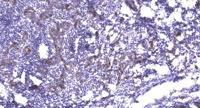 PI 3 Kinase Class 3 Polyclonal Antibody