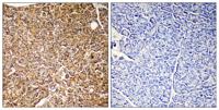 PI 3-Kinase p110γ Polyclonal Antibody