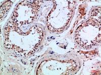 PI 3 Kinase p85β Polyclonal Antibody