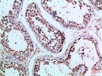 PI 3 Kinase p85β Polyclonal Antibody