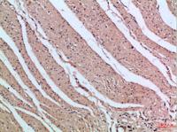 PI 3 Kinase p85β Polyclonal Antibody