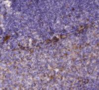 PI 3-kinase p85β Polyclonal Antibody