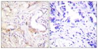 PIAS 3 Polyclonal Antibody