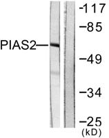 PIASx Polyclonal Antibody