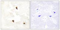 PIG11 Polyclonal Antibody