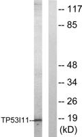 PIG11 Polyclonal Antibody