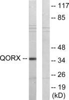 PIG3 Polyclonal Antibody