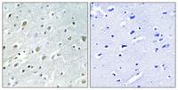 PIG-X Polyclonal Antibody