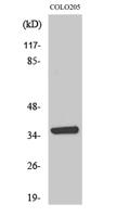 AASD-PPT Polyclonal Antibody