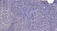 ABCB10 Polyclonal Antibody