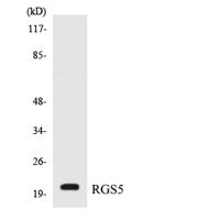 RGS5 Polyclonal Antibody