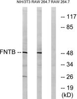 FTβ Polyclonal Antibody