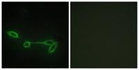 Fucokinase Polyclonal Antibody