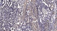 Pim-1 Polyclonal Antibody