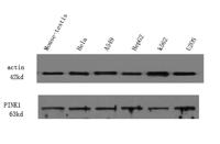 PINK1 Polyclonal Antibody