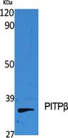 PITPβ Polyclonal Antibody