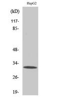 PITPβ Polyclonal Antibody