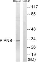 PITPβ Polyclonal Antibody