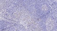 PITSLRE Polyclonal Antibody