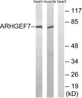 PIXβ Polyclonal Antibody