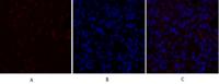 PDPK1 Polyclonal Antibody