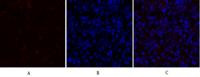 PDPK1 Polyclonal Antibody