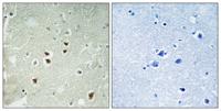 PDRG1 Polyclonal Antibody