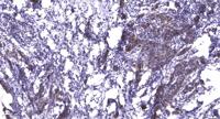 PDXDC1 Polyclonal Antibody