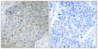 PEA3 Polyclonal Antibody