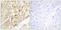 PEBP2β Polyclonal Antibody