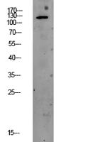 PEK/PERK Polyclonal Antibody