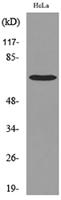 PEPCK-C Polyclonal Antibody