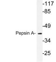 Pepsin A Polyclonal Antibody