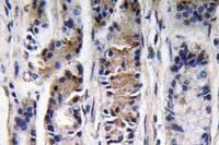 Pepsin C Polyclonal Antibody