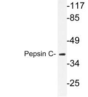 Pepsin C Polyclonal Antibody