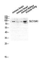 PEPT1 Polyclonal Antibody