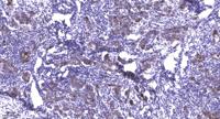 PEPT1 Polyclonal Antibody